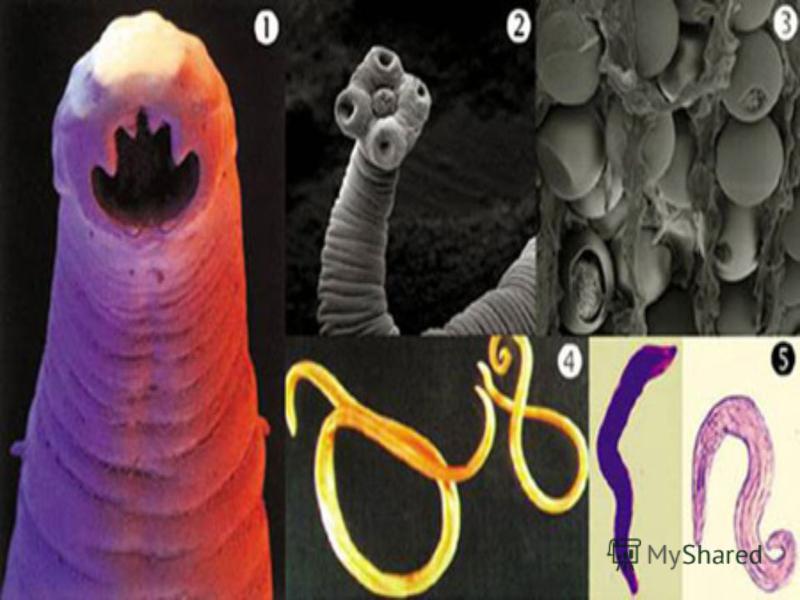 Организм паразит животного. Животные паразиты биология. Животные паразиты человека.