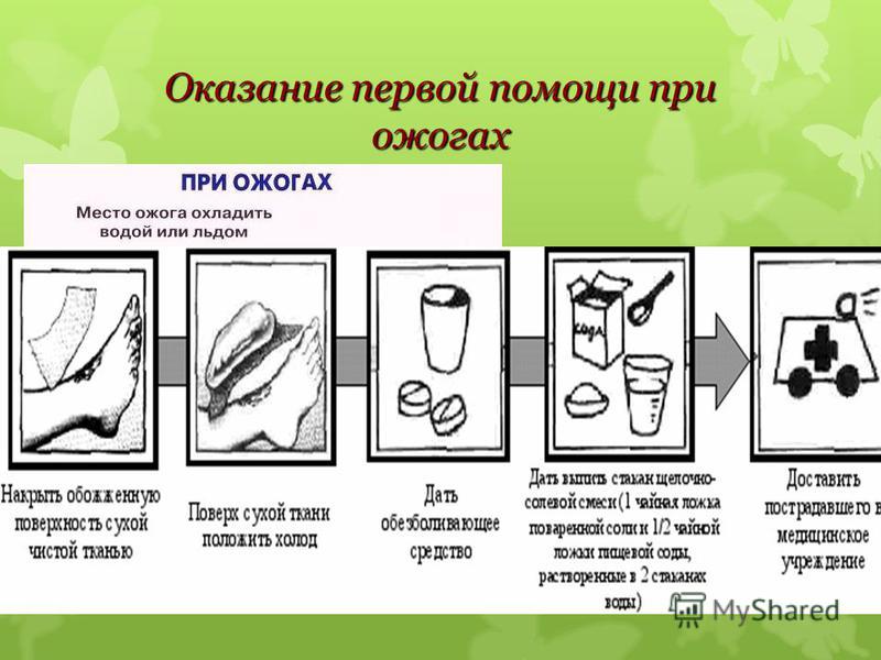 Схема оказания первой помощи при термических ожогах