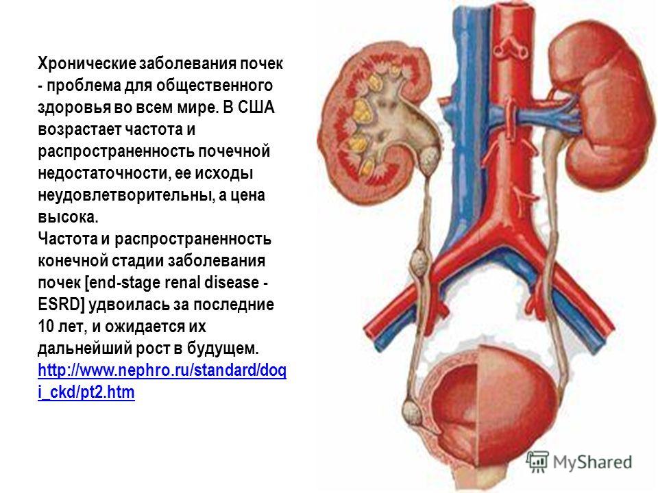 Болезни почек. Хронические заболевания почек. Храническое заболевания почек.