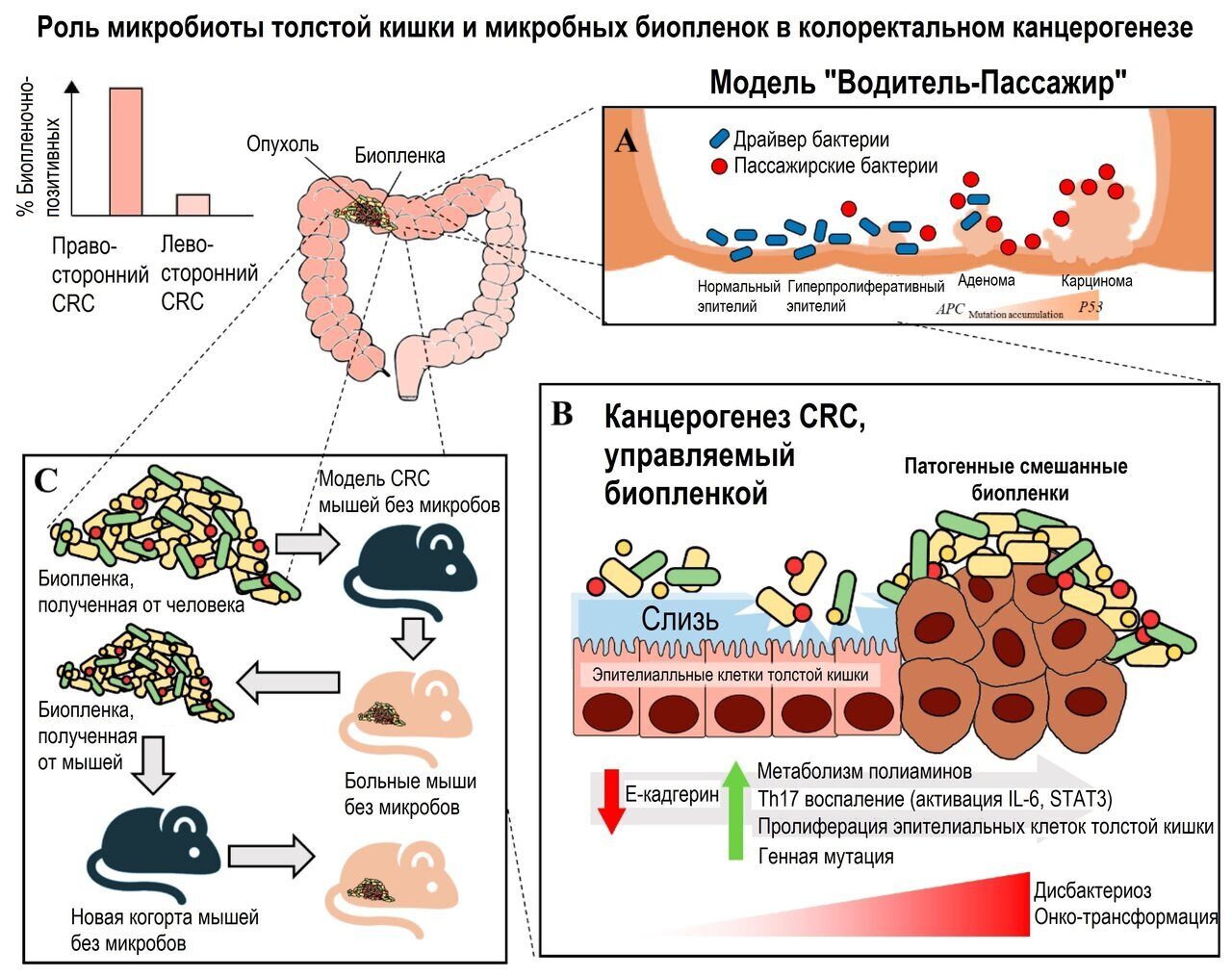 При раке кишечника цвет стула