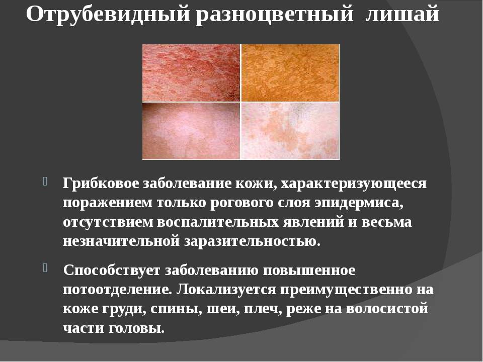 Определение кожного заболевания по фото