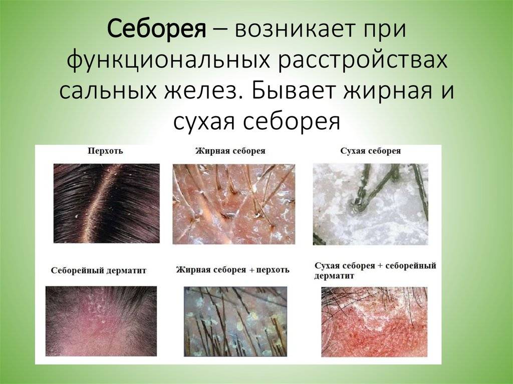 Определитель кожных заболеваний по фото