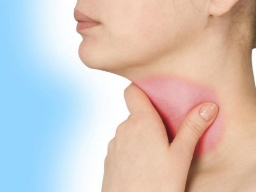 Боль в горле – первый признак ангины