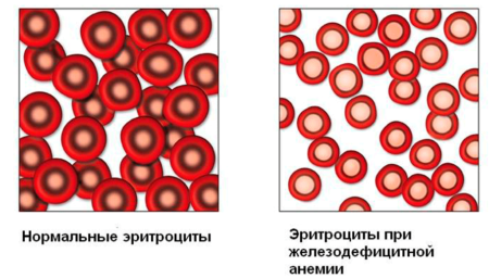 Почему падают показатели гемоглобина в крови, и как от этого можно избавиться разными способами?