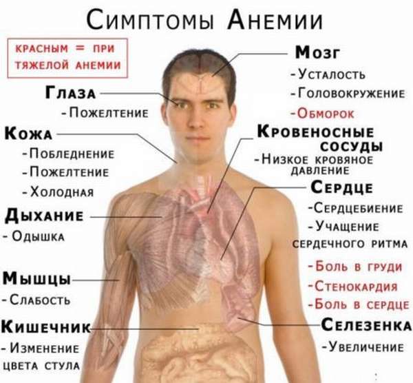 Опасности и последствия низкого гемоглобина с показателями ниже 80 г/л