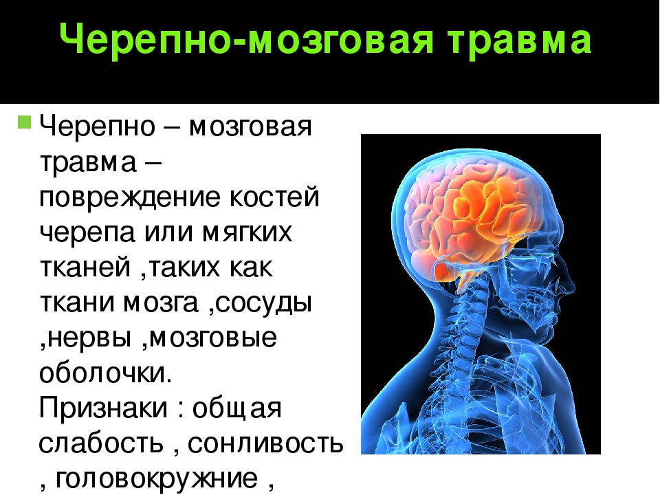 Травмы черепа и головного мозга. Черепно мозговые Травиа. Черепноиозгорвая травма. Черебномозговая травма.