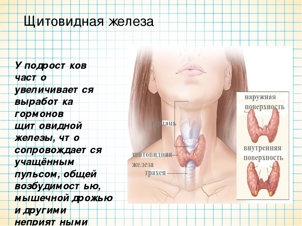 Гиперплазия щитовидной железы что это такое. Щитовидная железа у детей. Заболевания щитовидки. Патология щитовидной железы. Нарушение щитовидной жел.