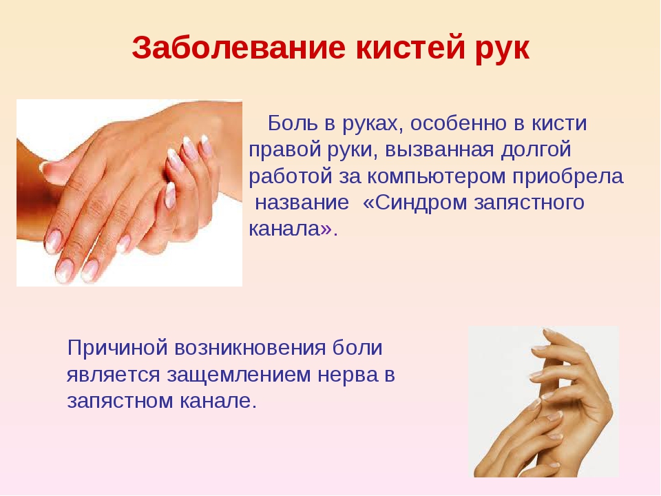Болит рука запястье чем лечить