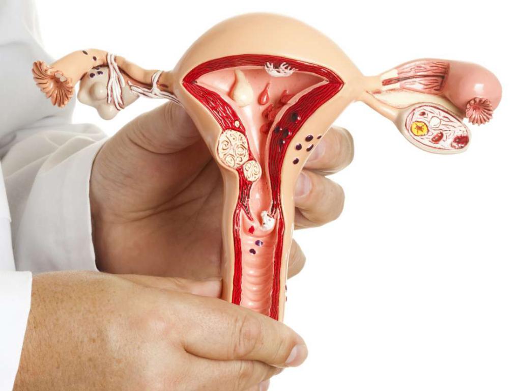 полип эндомерия матки