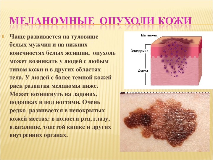 Дерматологические заболевания фото и описание