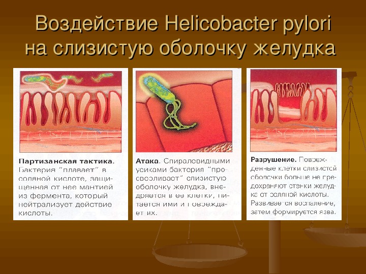 Bacteria del estomago helicobacter pylori tratamiento