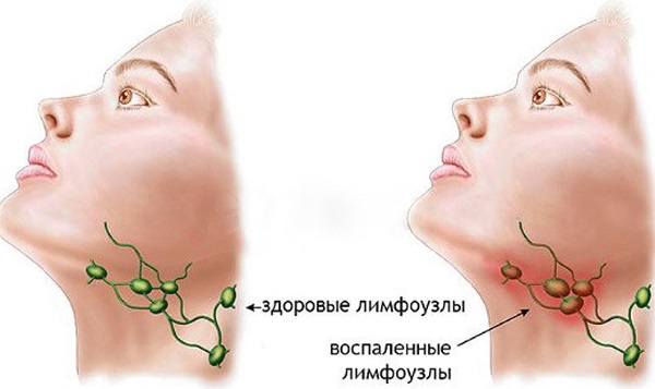 Лимфосистема человека. Схема в картинках, функции, заболевания, чистка. Методы, средства, массаж