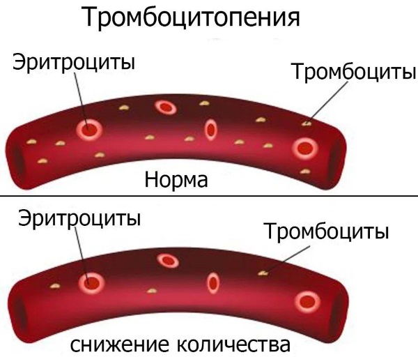 Синяки на ногах без причин у женщин. Почему появляются, лечение. К какому врачу обратиться