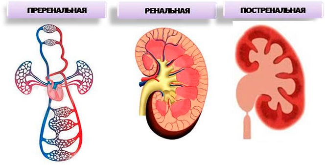 Синяки на ногах без причин у женщин. Почему появляются, лечение. К какому врачу обратиться