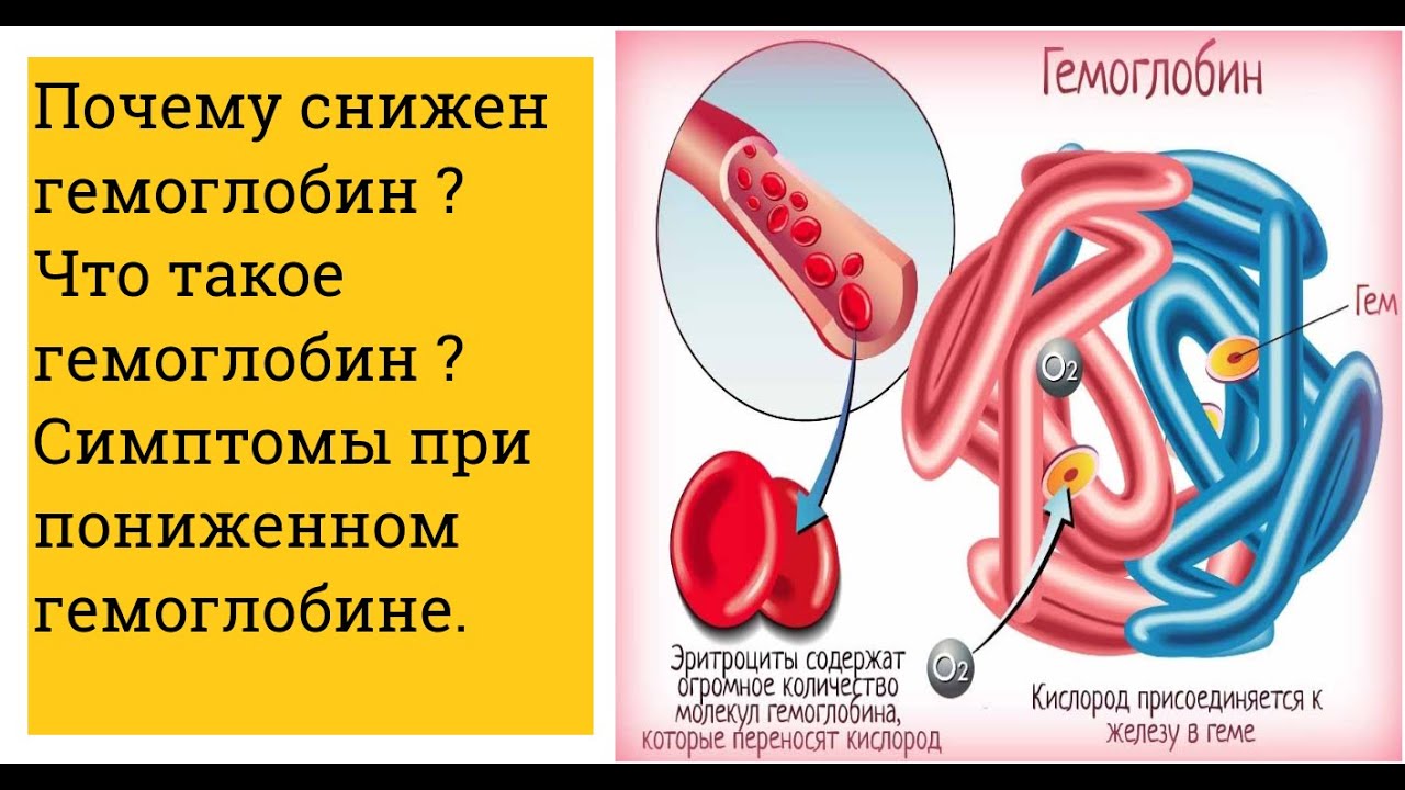 Последствия низкого гемоглобина у мужчин. Гемоглобин. Недостаток гемоглобина в крови. Гемоглобин симптомы. Причины снижения гемоглобина.