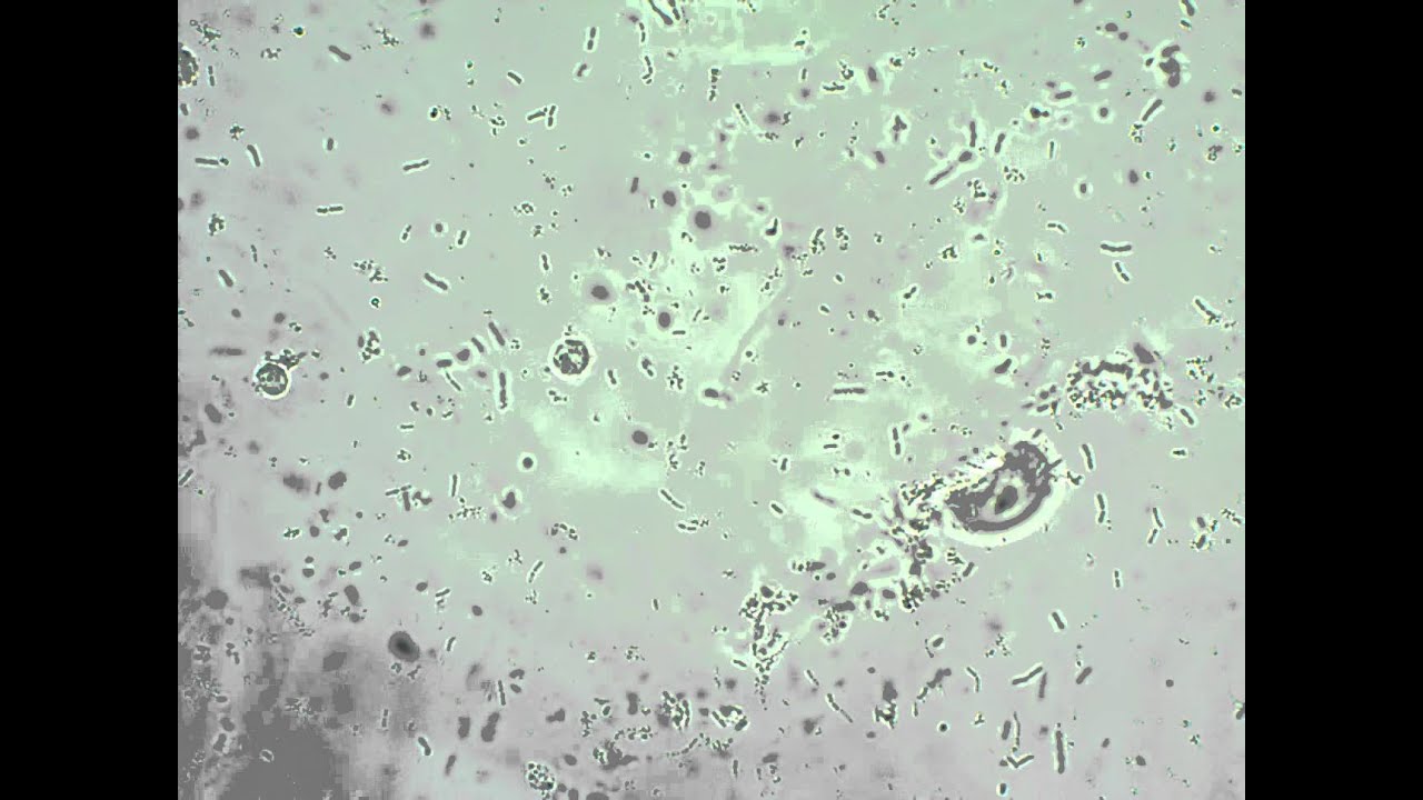 Бактерии и слизь в моче у женщин. Микроскопия мочи бактерии. Бактерии в моче микроскопия осадка. Микроскопия мочи палочки. Слизь в моче микроскопия.