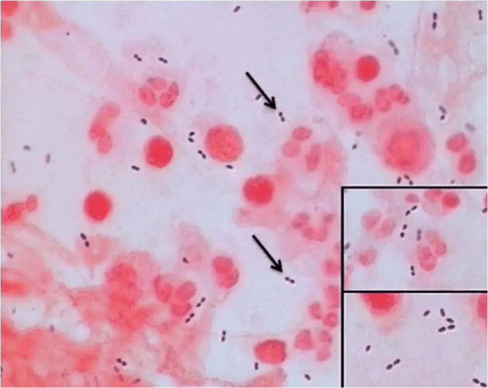 Streptococcus pneumoniae микроскопия. Хламидиоз микроскопия мазка. Стрептококк pneumoniae в мазке.