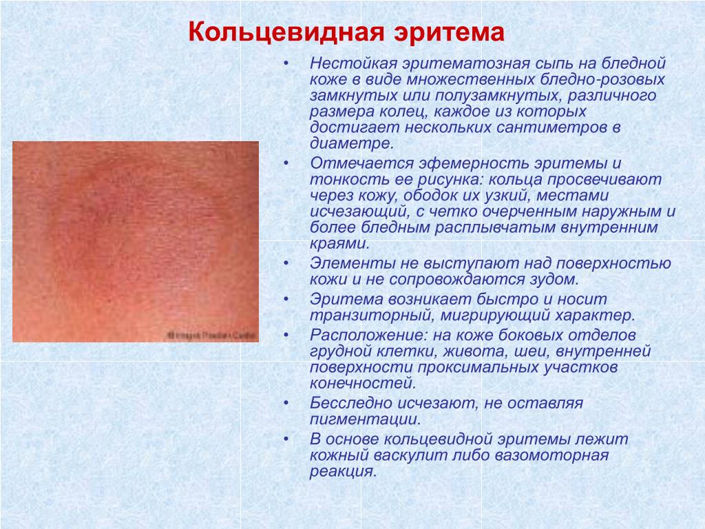 Дерматологические заболевания фото и описание