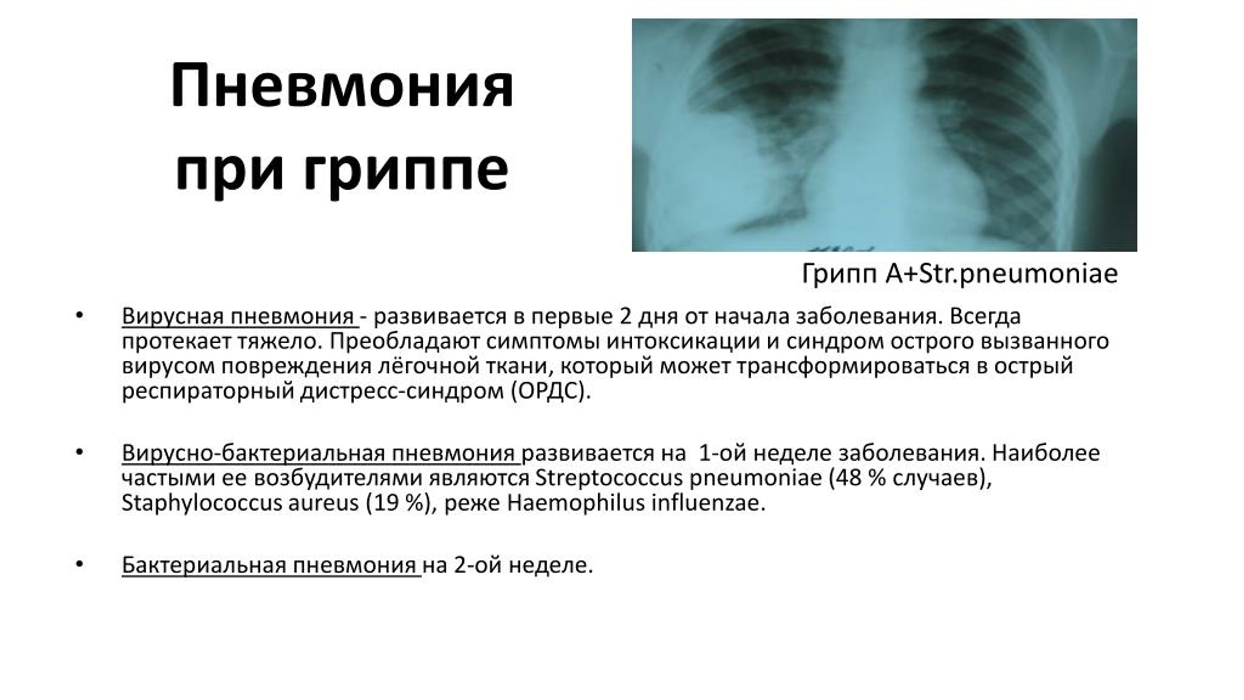 Атипичная пневмония симптомы. Гриппозная пневмония. Вирусная гриппозная пневмония. Гриппозная пневмония причины.