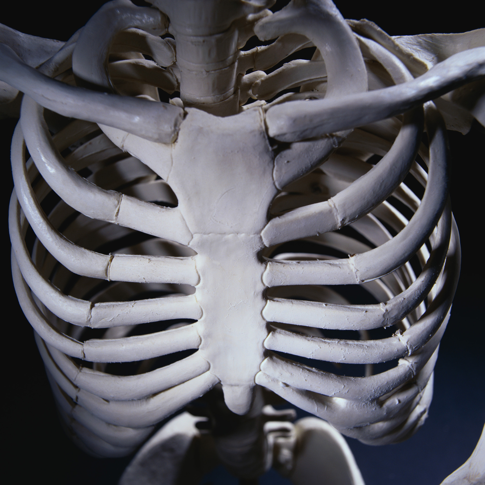 Переломы скелета. Грудина скелет. Скелет грудной клетки. Скелет грудной клетки человека. Скелет человека грудная клетка кости рёбра.