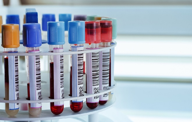 Лабораторные пробирки с анализами крови в подставке