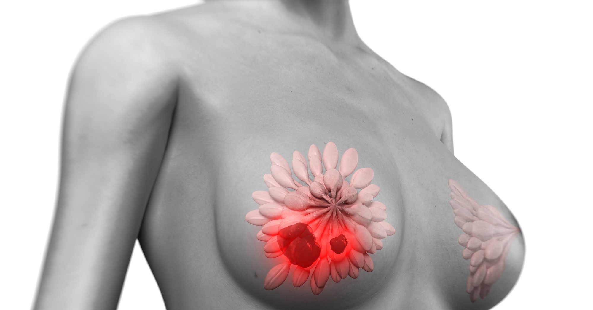 воспаление груди у женщин чем лечить фото 94