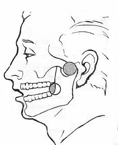 При открытии рта болит ухо. Электромиограмма ВНЧС. УВЧ ВНЧС.