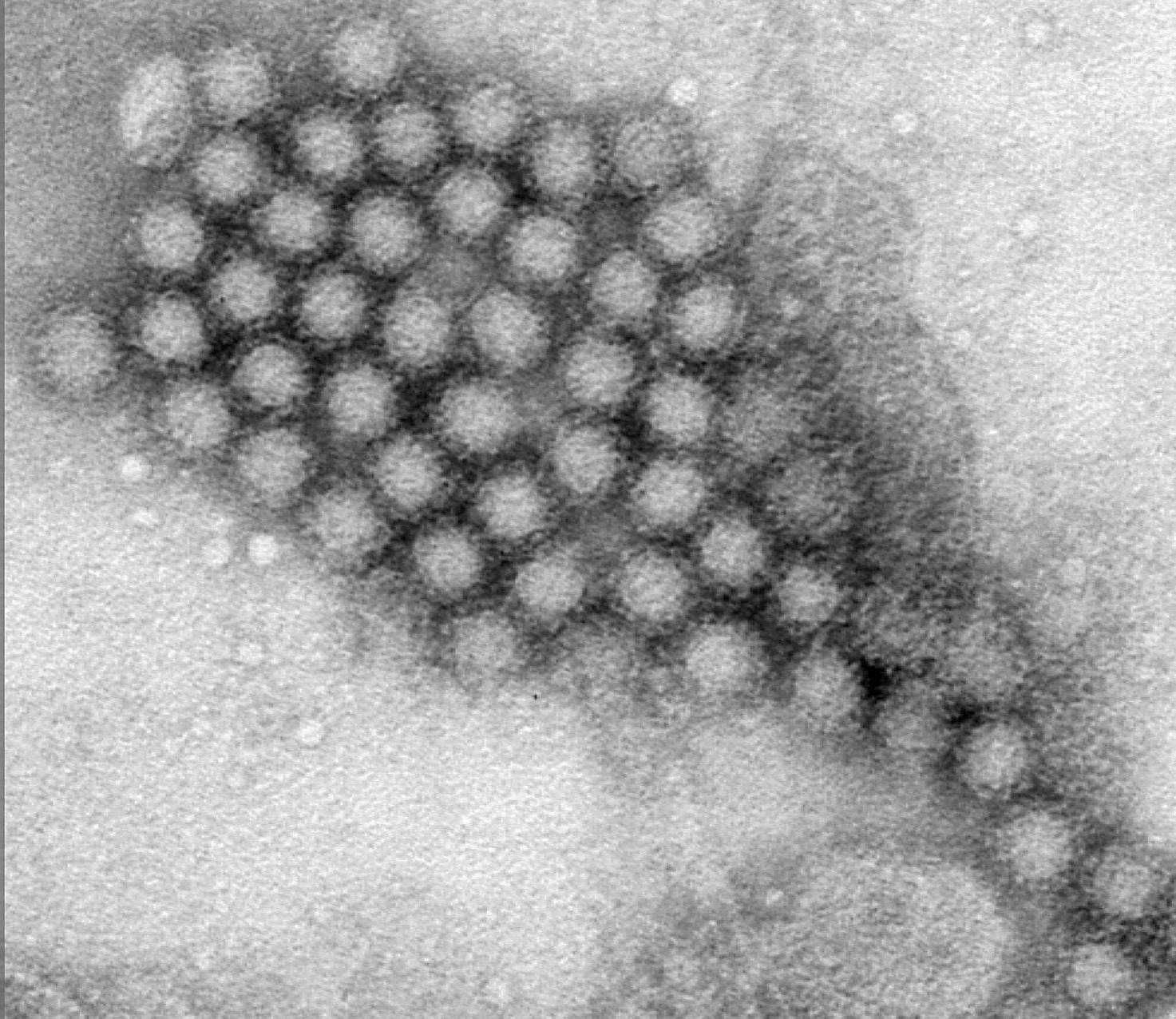 Генотипы норовируса. Caliciviridae микробиология. Норовирус под микроскопом. Диарея под микроскопом.