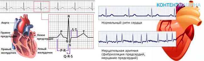 Сбился ритм. Восстановление ритма сердца. Как восстановить сердечный ритм. Как нормализовать сердечный ритм. Нормализует сердечный ритм.