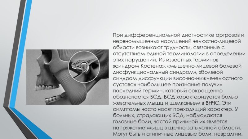Внчс симптомы. Дисфункция височно-нижнечелюстного сустава диагноз. Синдром Костена, дисфункция нижнечелюстного сустава. Дифференциальная диагностика артроза ВНЧС. Синдром поражения височно нижнечелюстного сустава.