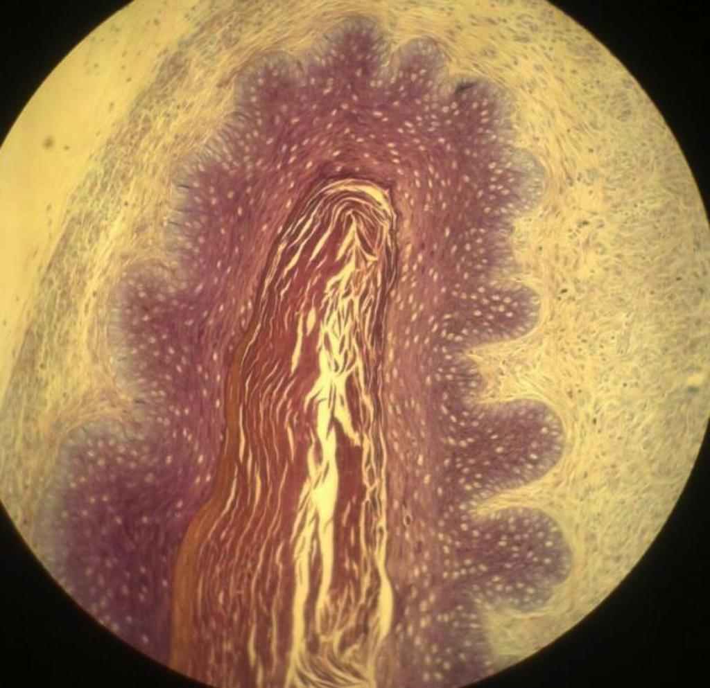 Gardnerella under the microscope