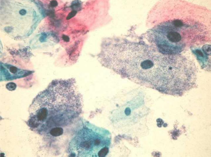 Bacteria under a microscope